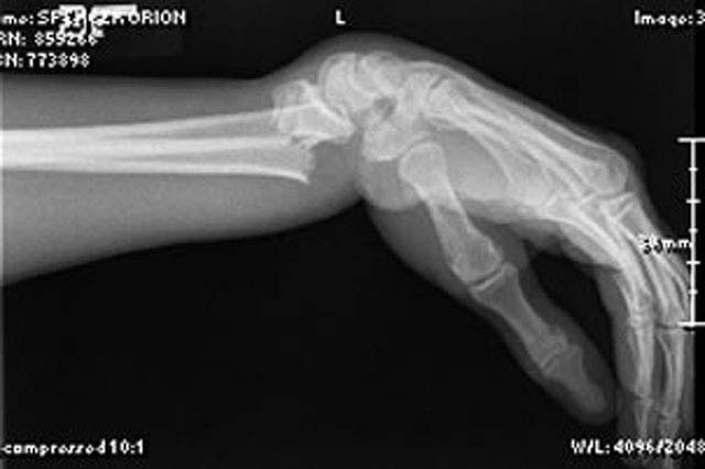 oj_wrist01
