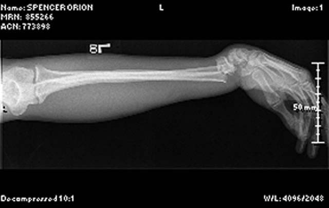 oj_wrist02