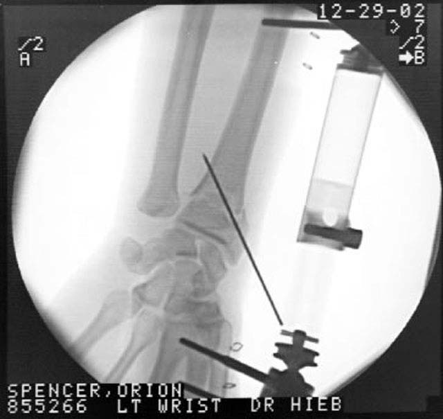 oj_wrist04