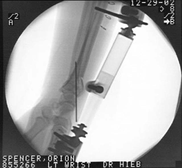 oj_wrist05