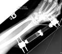 oj_wrist03